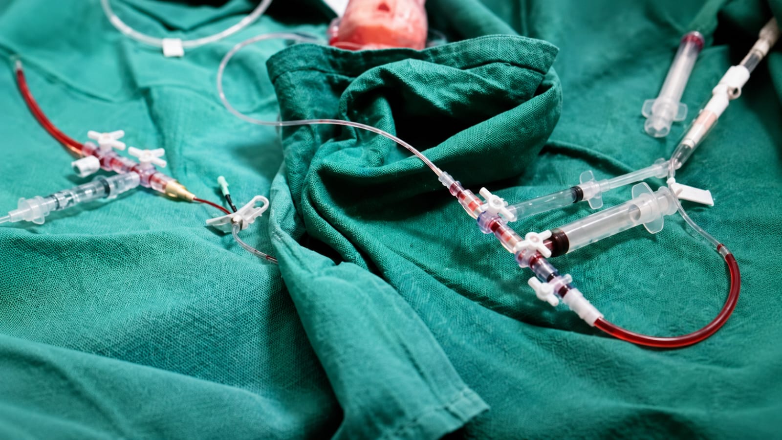 Exchange Transfusion